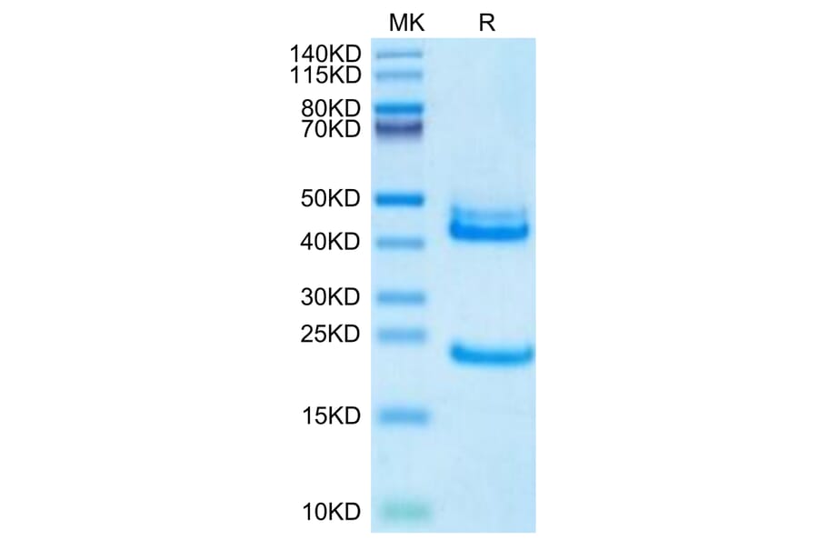 Tris-Bis PAGE - Recombinant Human IL-23A + IL-12B Protein (Biotin) (C-terminal His and Avi Tag) (A331683) - Antibodies.com