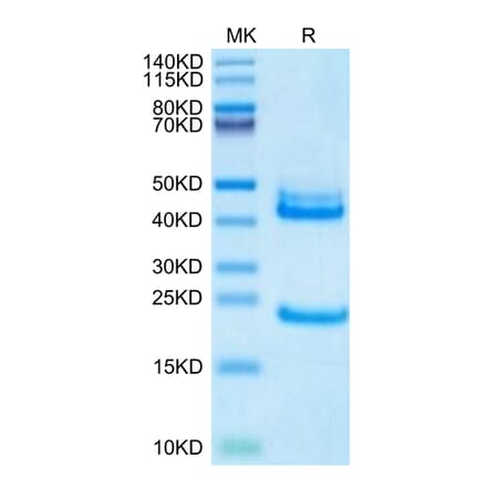 Tris-Bis PAGE - Recombinant Human IL-23A + IL-12B Protein (Biotin) (C-terminal His and Avi Tag) (A331683) - Antibodies.com