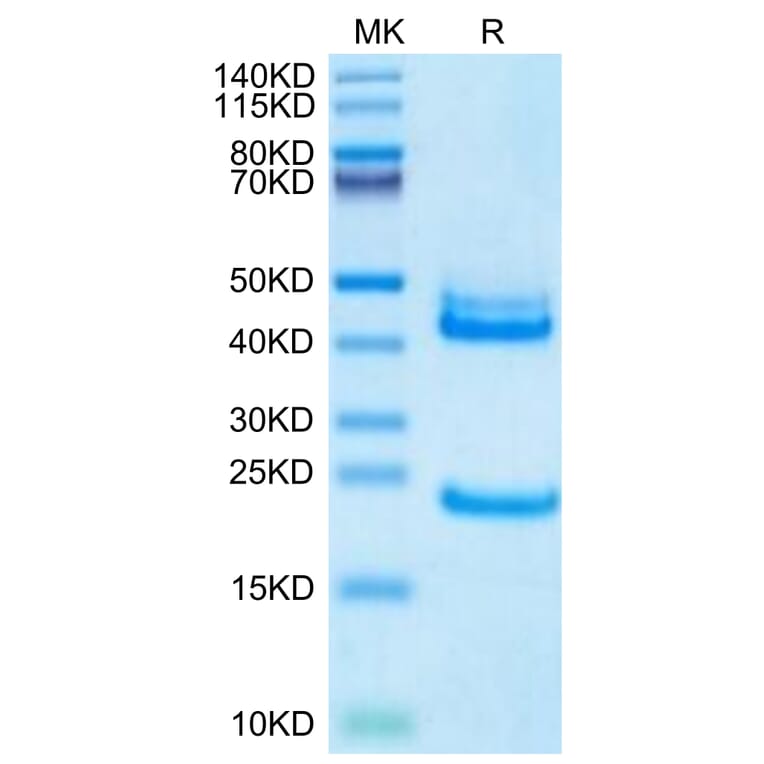 Tris-Bis PAGE - Recombinant Human IL-23A + IL-12B Protein (Biotin) (C-terminal His and Avi Tag) (A331683) - Antibodies.com