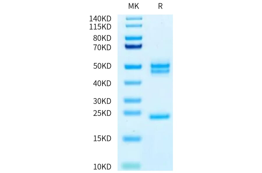 Tris-Bis PAGE - Recombinant Human IL-23A + IL-12B Protein (Biotin) (C-terminal His and Avi Tag) (A331685) - Antibodies.com