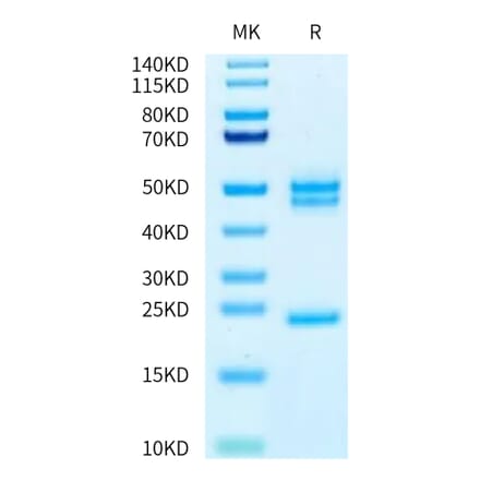 Tris-Bis PAGE - Recombinant Human IL-23A + IL-12B Protein (Biotin) (C-terminal His and Avi Tag) (A331685) - Antibodies.com