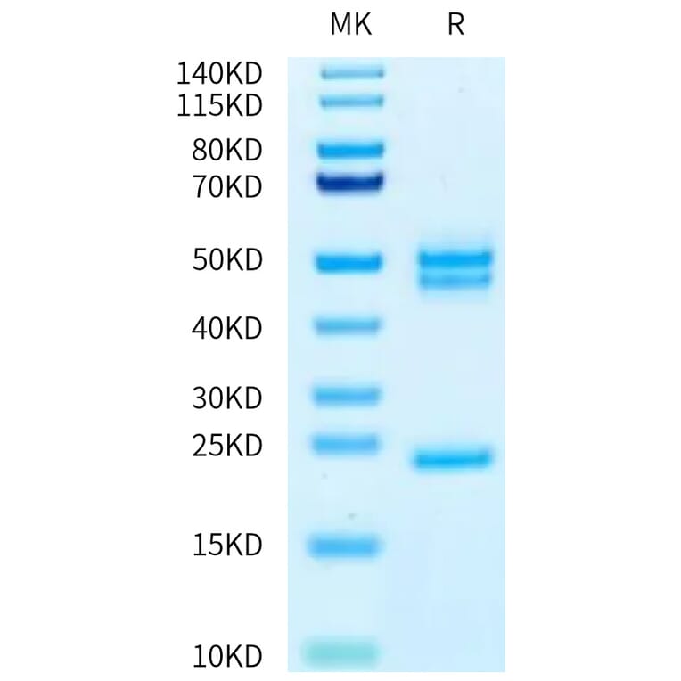 Tris-Bis PAGE - Recombinant Human IL-23A + IL-12B Protein (Biotin) (C-terminal His and Avi Tag) (A331685) - Antibodies.com