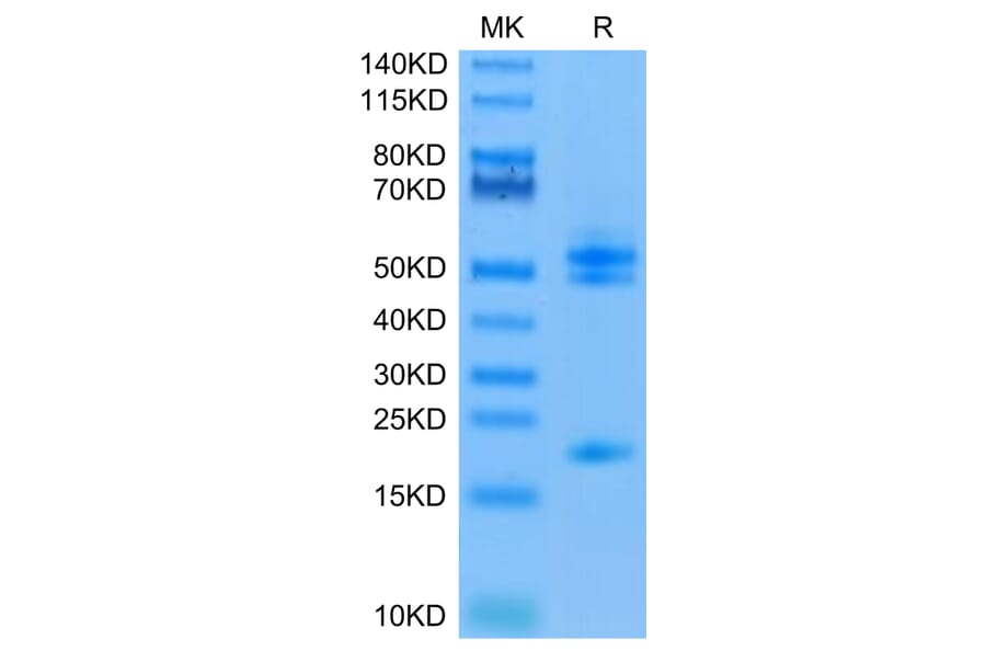 Tris-Bis PAGE - Recombinant Human IL-23A + IL-12B Protein (C-terminal His and Avi Tag) (A331686) - Antibodies.com