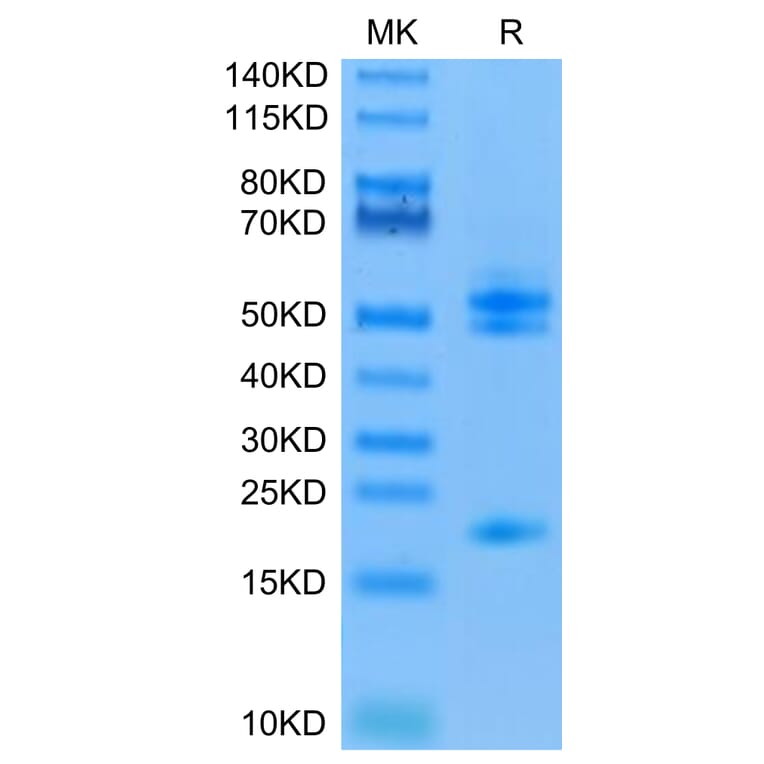 Tris-Bis PAGE - Recombinant Human IL-23A + IL-12B Protein (C-terminal His and Avi Tag) (A331686) - Antibodies.com