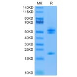 Tris-Bis PAGE - Recombinant Human IL-23A + IL-12B Protein (C-terminal His and Avi Tag) (A331686) - Antibodies.com