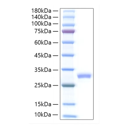 SDS-PAGE - Recombinant Mouse IL-27A Protein (C-terminal His Tag) (A331689) - Antibodies.com
