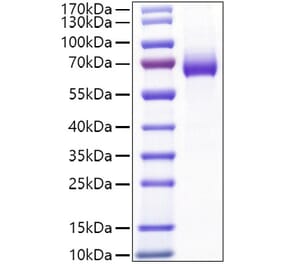 SDS-PAGE - Recombinant Mouse CD25 Protein (C-terminal Human Fc Tag) (A331690) - Antibodies.com