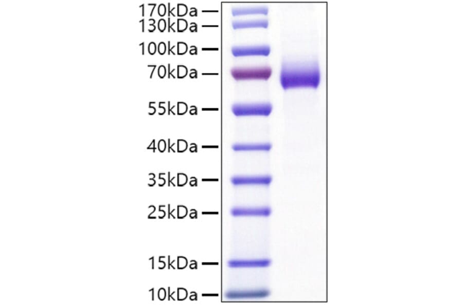 SDS-PAGE - Recombinant Mouse CD25 Protein (C-terminal Human Fc Tag) (A331690) - Antibodies.com