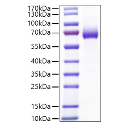 SDS-PAGE - Recombinant Mouse CD25 Protein (C-terminal Human Fc Tag) (A331690) - Antibodies.com
