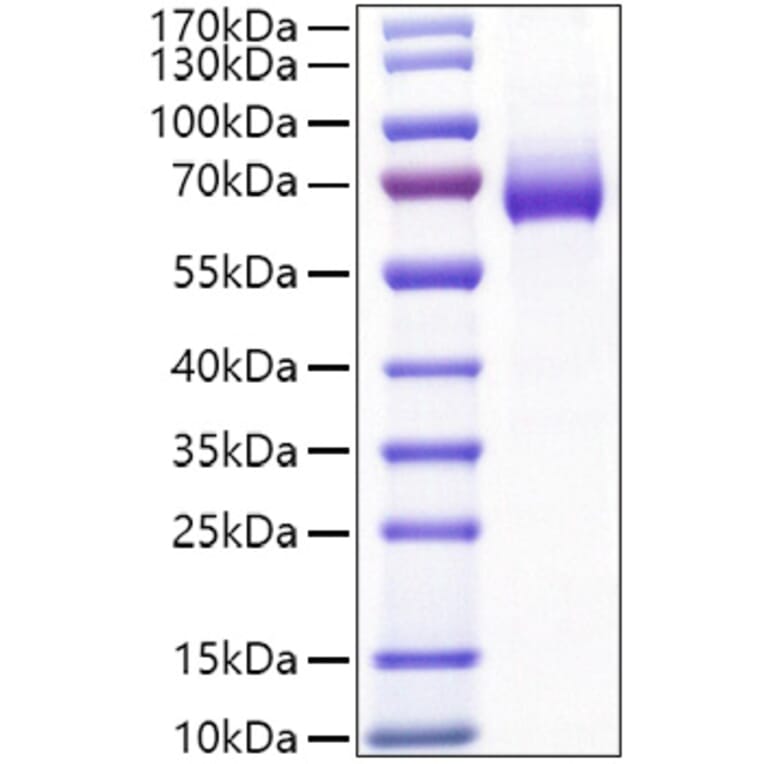 SDS-PAGE - Recombinant Mouse CD25 Protein (C-terminal Human Fc Tag) (A331690) - Antibodies.com