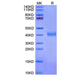 Tris-Bis PAGE - Recombinant Cynomolgus macaque IL2 Receptor beta Protein (C-terminal His Tag) (A331691) - Antibodies.com