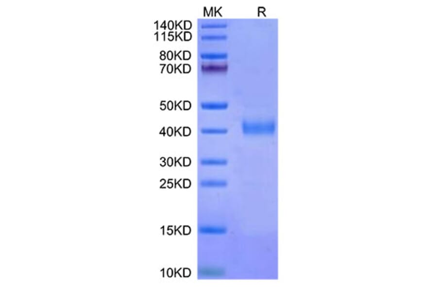 Tris-Bis PAGE - Recombinant Cynomolgus macaque IL2 Receptor beta Protein (C-terminal His Tag) (A331691) - Antibodies.com
