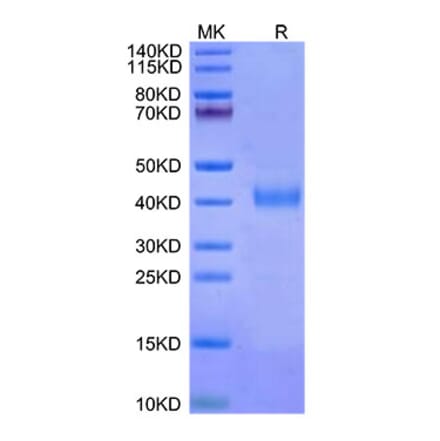 Tris-Bis PAGE - Recombinant Cynomolgus macaque IL2 Receptor beta Protein (C-terminal His Tag) (A331691) - Antibodies.com