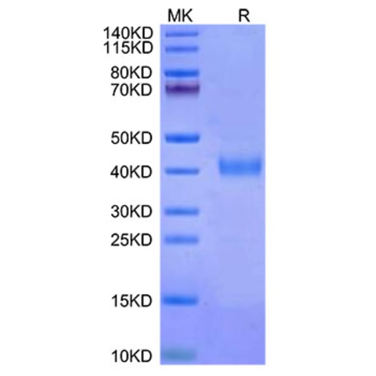Tris-Bis PAGE - Recombinant Cynomolgus macaque IL2 Receptor beta Protein (C-terminal His Tag) (A331691) - Antibodies.com