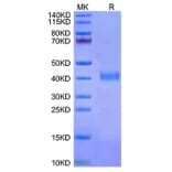 Tris-Bis PAGE - Recombinant Cynomolgus macaque IL2 Receptor beta Protein (C-terminal His Tag) (A331691) - Antibodies.com