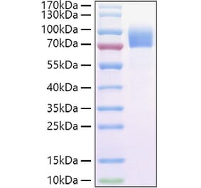 SDS-PAGE - Recombinant Cynomolgus macaque IL-2RG Protein (C-terminal Human Fc and Avi Tag) (A331692) - Antibodies.com