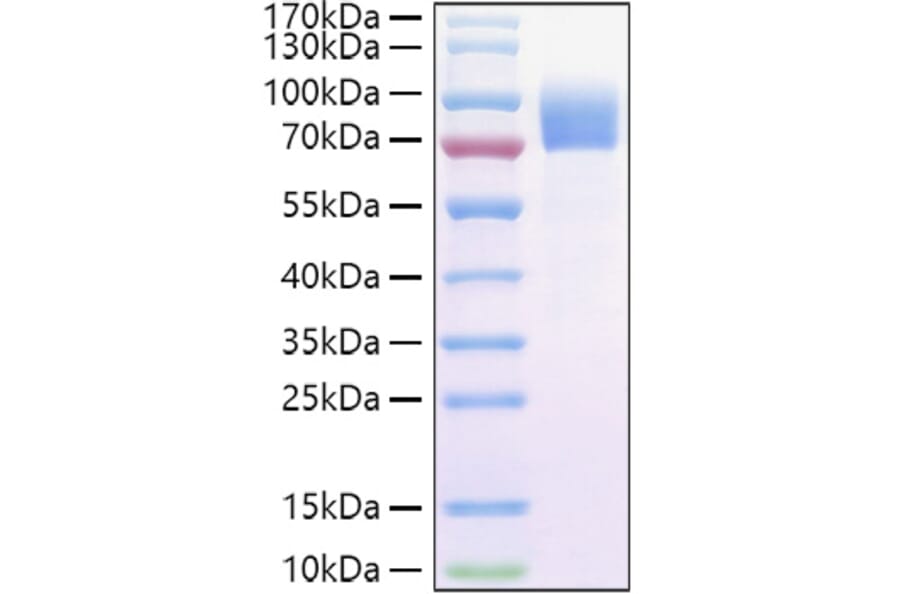 SDS-PAGE - Recombinant Cynomolgus macaque IL-2RG Protein (C-terminal Human Fc and Avi Tag) (A331692) - Antibodies.com