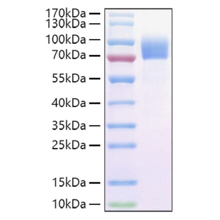SDS-PAGE - Recombinant Cynomolgus macaque IL-2RG Protein (C-terminal Human Fc and Avi Tag) (A331692) - Antibodies.com