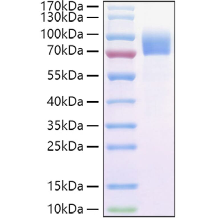 SDS-PAGE - Recombinant Cynomolgus macaque IL-2RG Protein (C-terminal Human Fc and Avi Tag) (A331692) - Antibodies.com