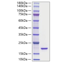 SDS-PAGE - Recombinant Mouse IL-36Ra Protein (A331694) - Antibodies.com