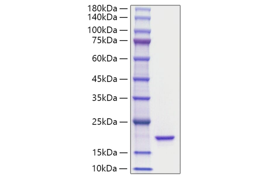SDS-PAGE - Recombinant Mouse IL-36Ra Protein (A331694) - Antibodies.com