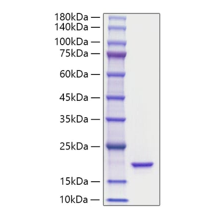 SDS-PAGE - Recombinant Mouse IL-36Ra Protein (A331694) - Antibodies.com
