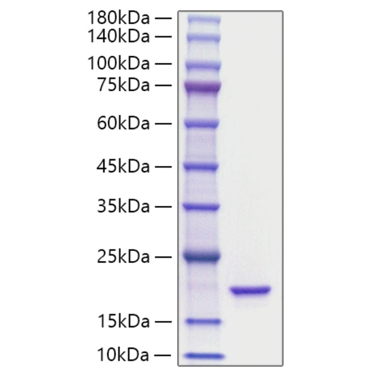 SDS-PAGE - Recombinant Mouse IL-36Ra Protein (A331694) - Antibodies.com