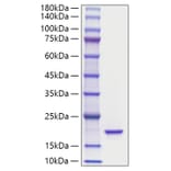 SDS-PAGE - Recombinant Mouse IL-36Ra Protein (A331694) - Antibodies.com