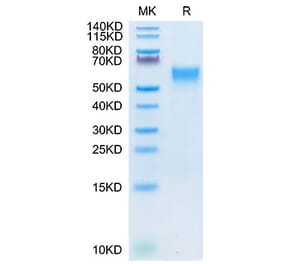 Tris-Bis PAGE - Recombinant Cynomolgus macaque IL-3RA Protein (C-terminal His Tag) (A331695) - Antibodies.com