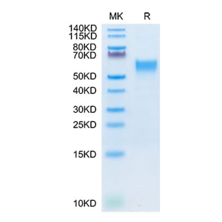 Tris-Bis PAGE - Recombinant Cynomolgus macaque IL-3RA Protein (C-terminal His Tag) (A331695) - Antibodies.com