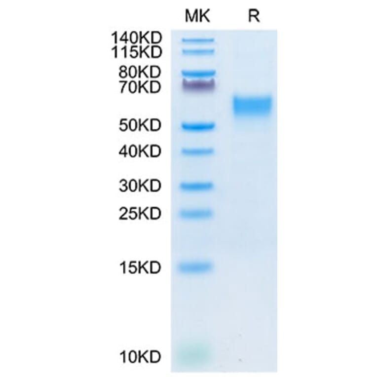 Tris-Bis PAGE - Recombinant Cynomolgus macaque IL-3RA Protein (C-terminal His Tag) (A331695) - Antibodies.com