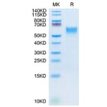 Tris-Bis PAGE - Recombinant Cynomolgus macaque IL-3RA Protein (C-terminal His Tag) (A331695) - Antibodies.com