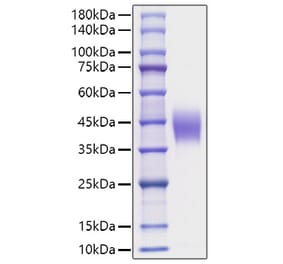 SDS-PAGE - Recombinant Mouse IL-4RA Protein (C-terminal His Tag) (A331696) - Antibodies.com