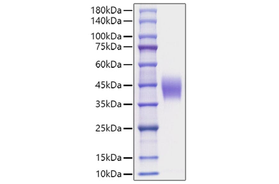 SDS-PAGE - Recombinant Mouse IL-4RA Protein (C-terminal His Tag) (A331696) - Antibodies.com
