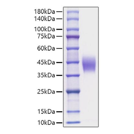 SDS-PAGE - Recombinant Mouse IL-4RA Protein (C-terminal His Tag) (A331696) - Antibodies.com