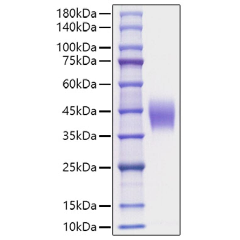 SDS-PAGE - Recombinant Mouse IL-4RA Protein (C-terminal His Tag) (A331696) - Antibodies.com