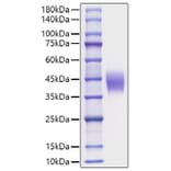 SDS-PAGE - Recombinant Mouse IL-4RA Protein (C-terminal His Tag) (A331696) - Antibodies.com