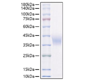 SDS-PAGE - Recombinant Rat IL-4RA Protein (C-terminal His Tag) (A331697) - Antibodies.com