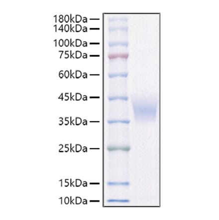 SDS-PAGE - Recombinant Rat IL-4RA Protein (C-terminal His Tag) (A331697) - Antibodies.com