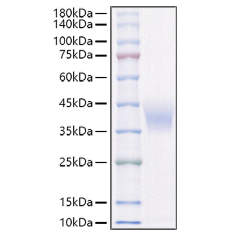 SDS-PAGE - Recombinant Rat IL-4RA Protein (C-terminal His Tag) (A331697) - Antibodies.com