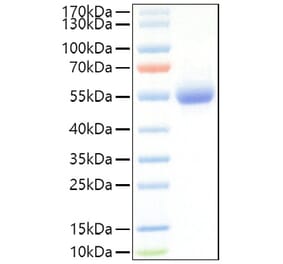SDS-PAGE - Recombinant Mouse IL-5RA Protein (C-terminal His Tag) (A331698) - Antibodies.com