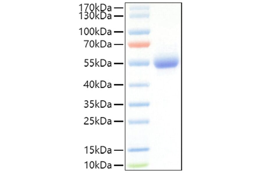 SDS-PAGE - Recombinant Mouse IL-5RA Protein (C-terminal His Tag) (A331698) - Antibodies.com