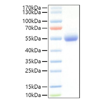 SDS-PAGE - Recombinant Mouse IL-5RA Protein (C-terminal His Tag) (A331698) - Antibodies.com