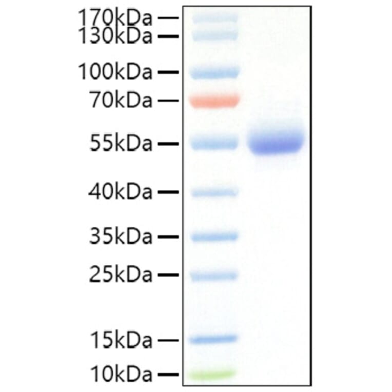 SDS-PAGE - Recombinant Mouse IL-5RA Protein (C-terminal His Tag) (A331698) - Antibodies.com