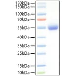 SDS-PAGE - Recombinant Mouse IL-5RA Protein (C-terminal His Tag) (A331698) - Antibodies.com