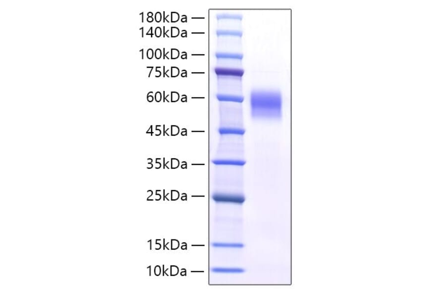 SDS-PAGE - Recombinant Mouse IL-6RA Protein (C-terminal His Tag) (A331699) - Antibodies.com