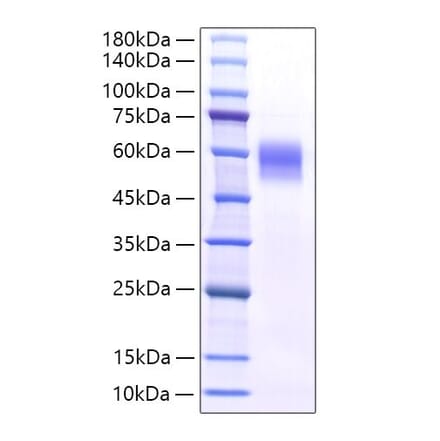 SDS-PAGE - Recombinant Mouse IL-6RA Protein (C-terminal His Tag) (A331699) - Antibodies.com