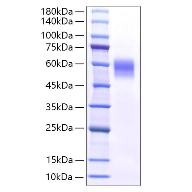 SDS-PAGE - Recombinant Mouse IL-6RA Protein (C-terminal His Tag) (A331699) - Antibodies.com