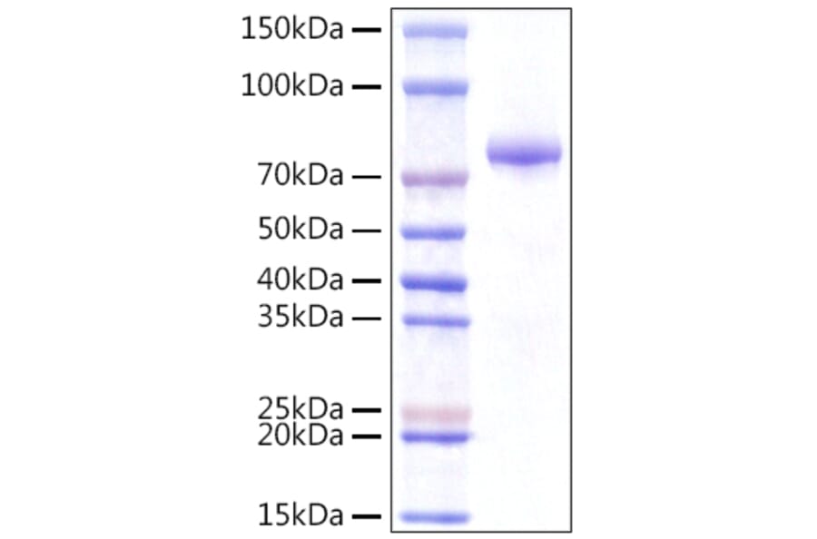 SDS-PAGE - Recombinant Human INTS14 Protein (N-terminal Rabbit Fc Tag) (A331701) - Antibodies.com