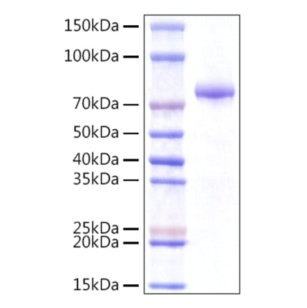 SDS-PAGE - Recombinant Human INTS14 Protein (N-terminal Rabbit Fc Tag) (A331701) - Antibodies.com